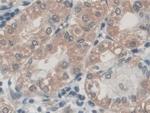 Palladin Antibody in Immunohistochemistry (Paraffin) (IHC (P))