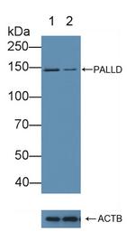 Palladin Antibody in Western Blot (WB)