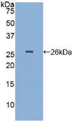 PGA5 Antibody in Western Blot (WB)