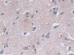 PGK1 Antibody in Immunohistochemistry (Paraffin) (IHC (P))