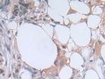 PGK1 Antibody in Immunohistochemistry (Paraffin) (IHC (P))