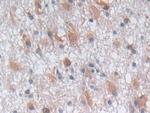 PGK1 Antibody in Immunohistochemistry (Paraffin) (IHC (P))