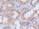 PGK1 Antibody in Immunohistochemistry (Paraffin) (IHC (P))