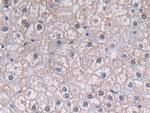 PGK1 Antibody in Immunohistochemistry (Paraffin) (IHC (P))