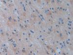 PSAT1 Antibody in Immunohistochemistry (Paraffin) (IHC (P))