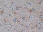 PSAT1 Antibody in Immunohistochemistry (Paraffin) (IHC (P))