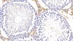 PZP Antibody in Immunohistochemistry (Paraffin) (IHC (P))