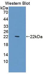 PDCD6 Antibody in Western Blot (WB)