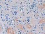 GCDFP-15 Antibody in Immunohistochemistry (Paraffin) (IHC (P))