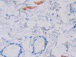 GCDFP-15 Antibody in Immunohistochemistry (Paraffin) (IHC (P))