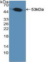 PSMC1 Antibody in Western Blot (WB)