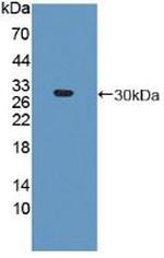 PSMA5 Antibody in Western Blot (WB)