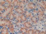 PSMB9 Antibody in Immunohistochemistry (Paraffin) (IHC (P))