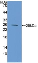 PSMB9 Antibody in Western Blot (WB)