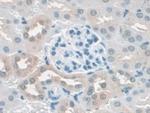 SCAF11 Antibody in Immunohistochemistry (Paraffin) (IHC (P))