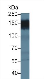 PPFIA1 Antibody in Western Blot (WB)