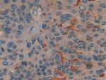 PKM2 Antibody in Immunohistochemistry (Paraffin) (IHC (P))