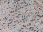 PKM2 Antibody in Immunohistochemistry (Paraffin) (IHC (P))