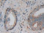 PKM2 Antibody in Immunohistochemistry (Paraffin) (IHC (P))