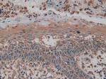 PKM2 Antibody in Immunohistochemistry (Paraffin) (IHC (P))