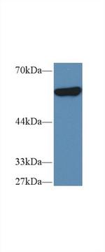 PKM2 Antibody in Western Blot (WB)