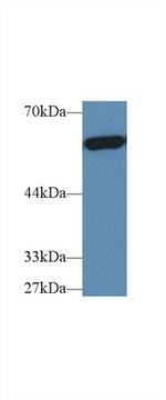 PKM2 Antibody in Western Blot (WB)