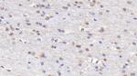 RANK (CD265) Antibody in Immunohistochemistry (Paraffin) (IHC (P))