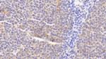 RANK (CD265) Antibody in Immunohistochemistry (Paraffin) (IHC (P))