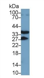 RANK (CD265) Antibody in Western Blot (WB)