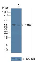 RANK (CD265) Antibody in Western Blot (WB)