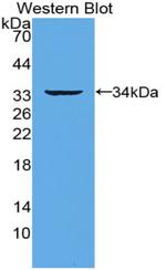 RANK (CD265) Antibody in Western Blot (WB)