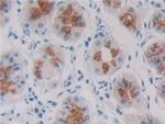 REG1B Antibody in Immunohistochemistry (Paraffin) (IHC (P))