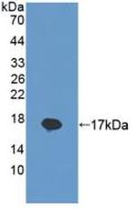 REG1B Antibody in Western Blot (WB)