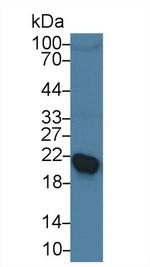 RBP4 Antibody in Western Blot (WB)