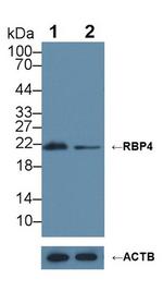 RBP4 Antibody in Western Blot (WB)