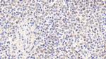 RNASEH2A Antibody in Immunohistochemistry (Paraffin) (IHC (P))