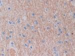 SHMT2 Antibody in Immunohistochemistry (Paraffin) (IHC (P))