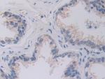 SHMT2 Antibody in Immunohistochemistry (Paraffin) (IHC (P))