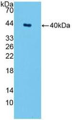 SPTLC1 Antibody in Western Blot (WB)