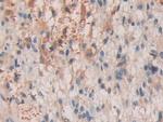 SHC3 Antibody in Immunohistochemistry (Paraffin) (IHC (P))