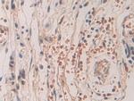 SHC3 Antibody in Immunohistochemistry (Paraffin) (IHC (P))