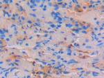 STAT4 Antibody in Immunohistochemistry (Paraffin) (IHC (P))