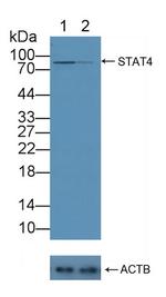 STAT4 Antibody in Western Blot (WB)