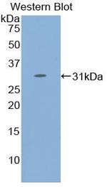 STAT4 Antibody in Western Blot (WB)