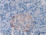 SLIT1 Antibody in Immunohistochemistry (Paraffin) (IHC (P))