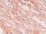 SLIT1 Antibody in Immunohistochemistry (Paraffin) (IHC (P))