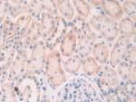 SLIT1 Antibody in Immunohistochemistry (Paraffin) (IHC (P))