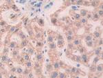 SLIT1 Antibody in Immunohistochemistry (Paraffin) (IHC (P))