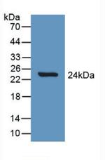 SLIT1 Antibody in Western Blot (WB)