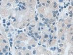 SNRPD1 Antibody in Immunohistochemistry (Paraffin) (IHC (P))